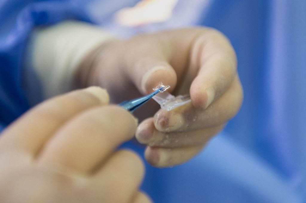 medicine, treatment, human, eye surgery, surgery, medical, operation, blue medical, blue eye, blue medicine, eye surgery, eye surgery, eye surgery, eye surgery, eye surgery, surgery